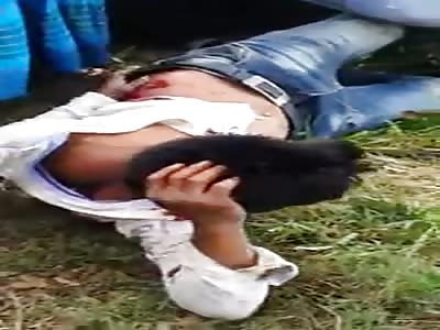 ACCIDENT: man suffers to lose his beauty in accident