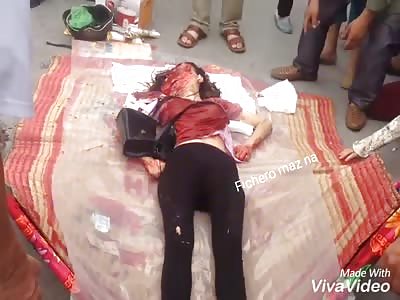 Woman`s face becomes a horrific mask after accident