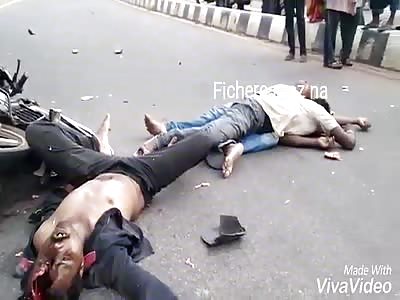 ACCIDENT: man becomes brainless after suffering serious accident