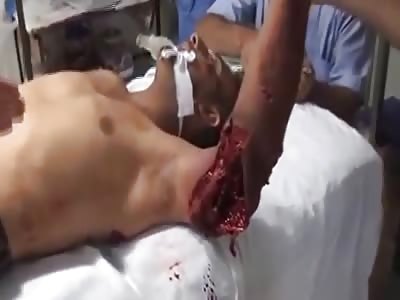 small wound in the arm