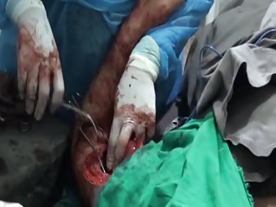 This is a good job if you like gore