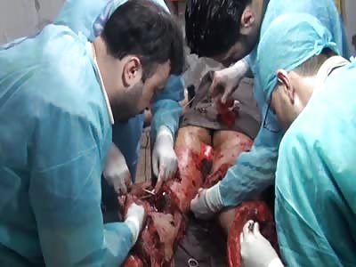 his leg is destroyed by stepping on a mine