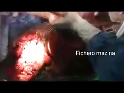 beautiful cut by doctors