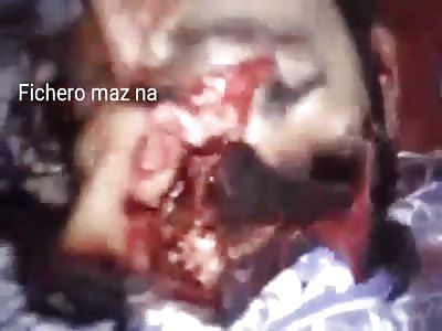 Man with empty head.