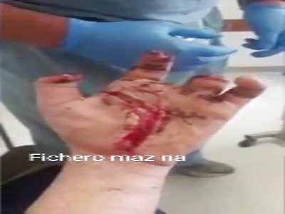 man abuse of masturbation