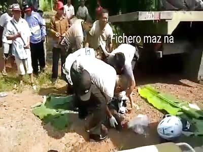 man whose head was squeezed