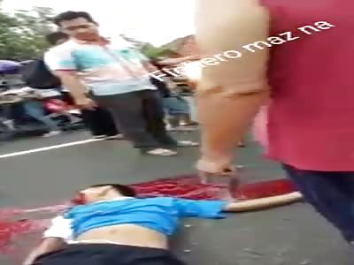 bleeding on the road