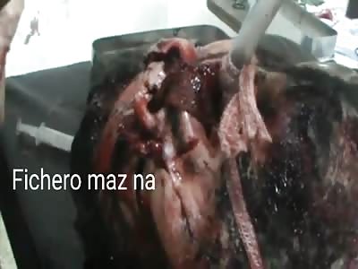 man totally disfigured 2