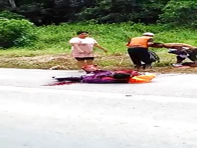 MAN WITH THE ROTE LEG