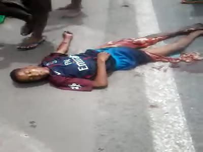 MAN SUFFER TERRIBLE ACCIDENT