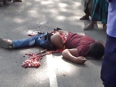 MAN WITH THE DEPRESSED FOOT