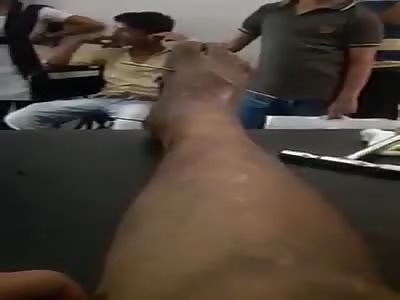 motorcycle accident leaves man nailed with pieces of motorcycle