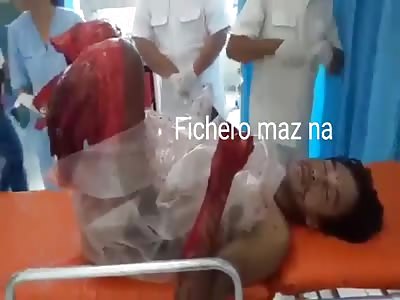 BRUTAL: MAN LOSES BOTH LEGS IN ACCIDENT