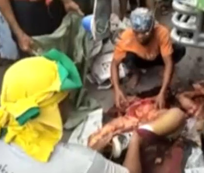 COLLECTING BODY PIECES 