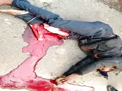 Elderly Man in Total Agony ...Ripped Leg after Accident 