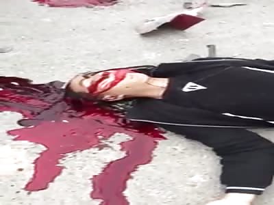 ACCIDENT OF MOTORCYCLISTS