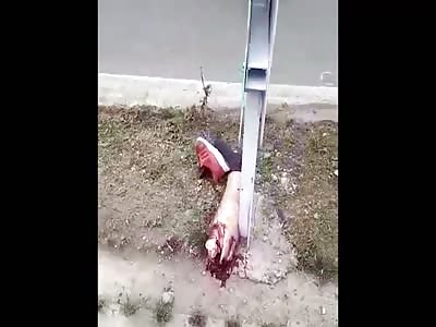 OUCH... Man Loses her Foot in Motorcycle Accident