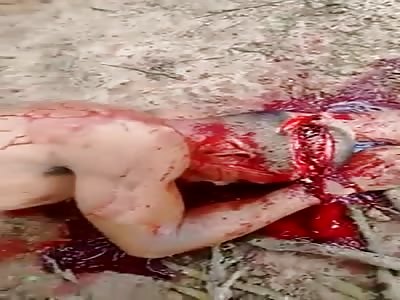 Man was hacked up by Many Many Machete Blows