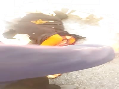 WTF TERRIBLE ACCIDENT