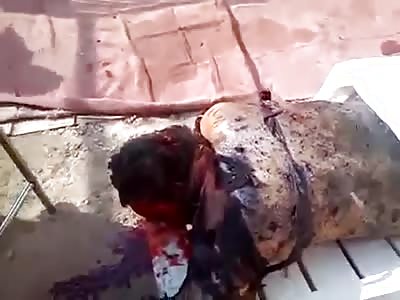 BODY OF MAN BURNED