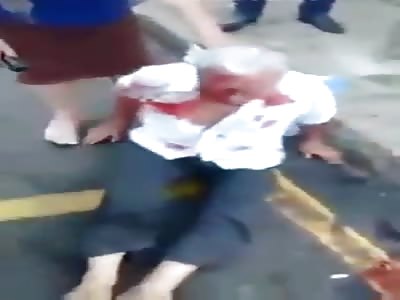 MAN BRUTALLY HIT WITH KNIFE