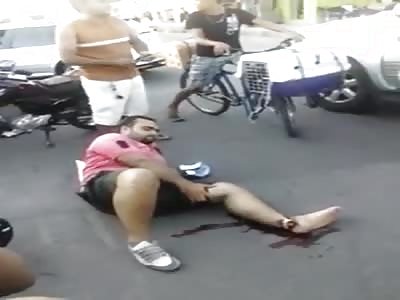 MAN WITH BROKEN FOOT