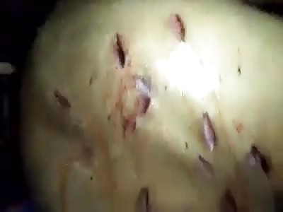 MAN WITH WOUNDS OF WHITE WEAPON