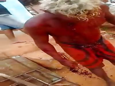 Young man shredded after getting involved in a fight with his own brother.