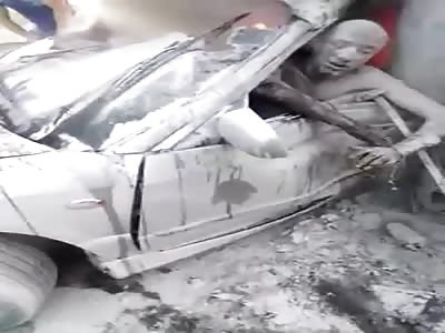 MAN BURNS WITHIN CART