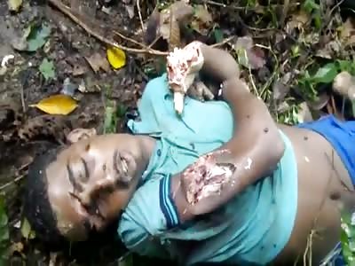 Man Mutilated by Drug Dealers