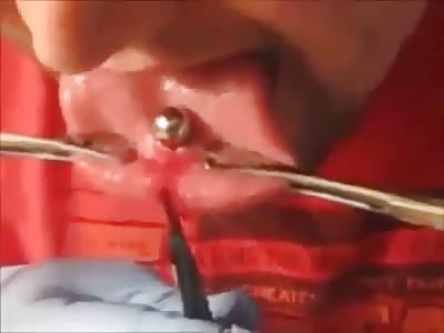 IDIOT MAN IS SHORTED IN HALF THE LANGUAGE