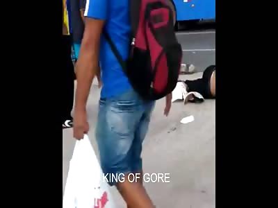 Vacated Skull...Man legt with No Brain after Brutal Accident 