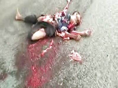 TERRIBLE ACCIDENT LETS MEN WITH EXPOSED INTESTINES