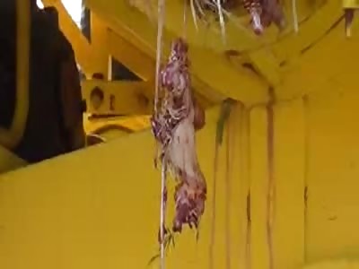 man loses foot in the machine