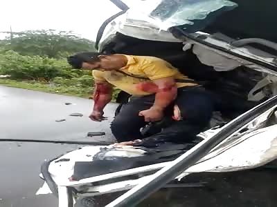 OUCH! THAT MUST HURT