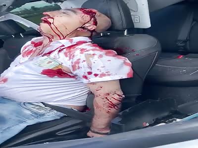 Horrific and bloody Car Crash Aftermath 