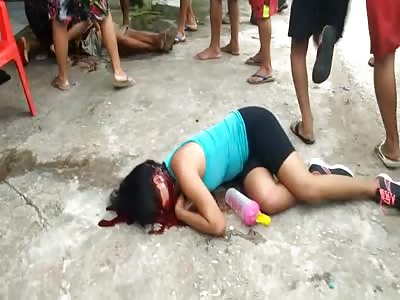 Pretty Girl Shot in the Face Still Agonizing on the Sidewalk