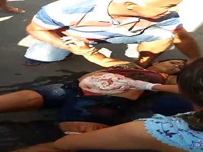 Accident Leaves Woman with Guts Hanging Out Abdomen in Brazil.