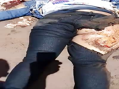 Poor Girl... Bikerâ€™s Brain Bits Ejaculated Across Road