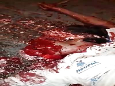 Why You Should Always Wear a Helmet on a Bicycle