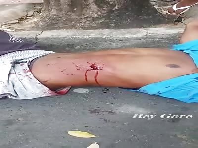 WOUNDED MAN WITH SHOT