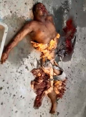 Grenade in a Pocket Explosion Result