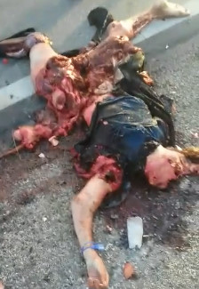 Hello, My Guts are Out