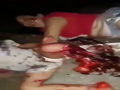 Mom's and Daughter Bodies Terribly Damage in Brutal Road Accident