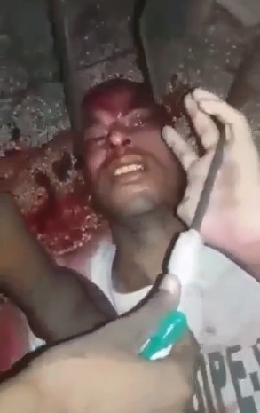 Bloody Madness From the Brazilian Prison 