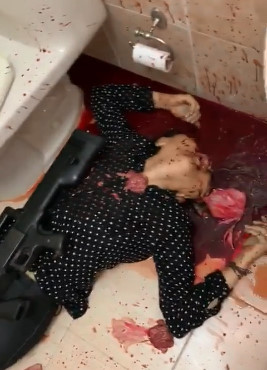 Insane SHOTGUN Suicide Aftermath!