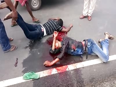 One Agonizes While his Dead Buddy is Dragged Off