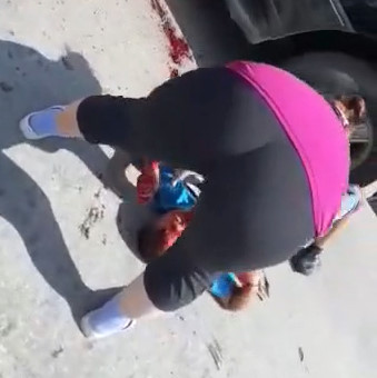 Helmetless Biker With His Skull Ripped Open And His Deceased Mate.