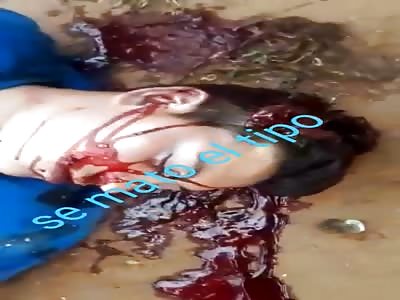 SUICIDE FOR HEAD SHOT