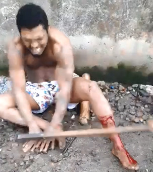 Thief Gets Fingers on Both Hands Crudely Broken with Iron Bar